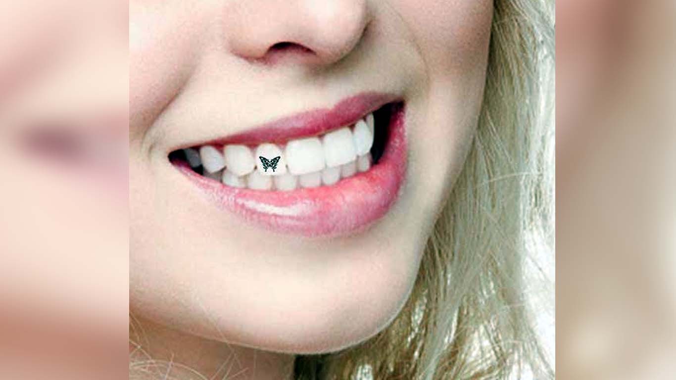 چینیوں میں دانتوں پر ٹیٹو بنوانے کا فیش مقبول ہونے لگا