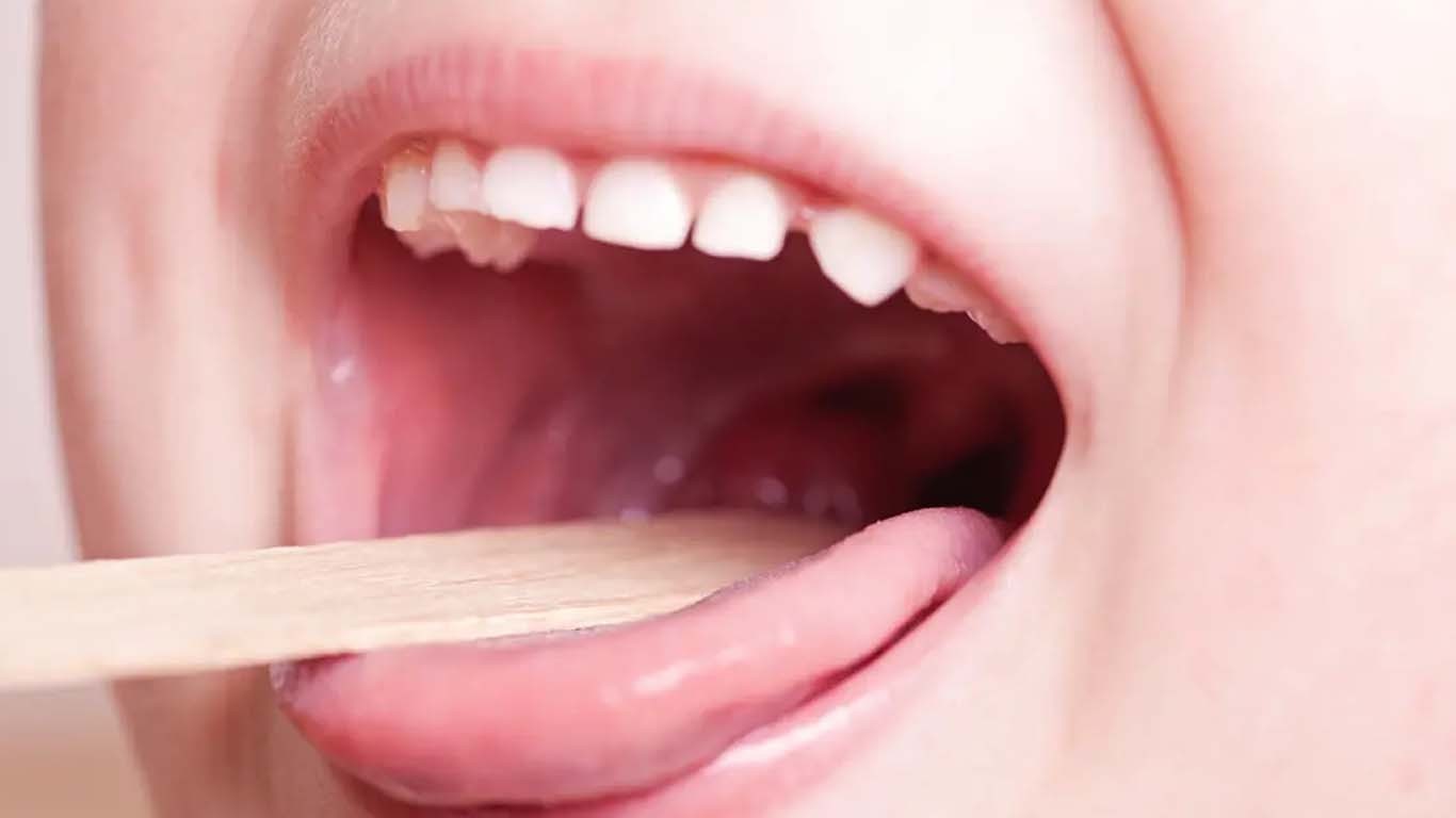 دادو میں گلے کی خطرناک بیماری سے بچوں کی اموات بڑھ گئیں