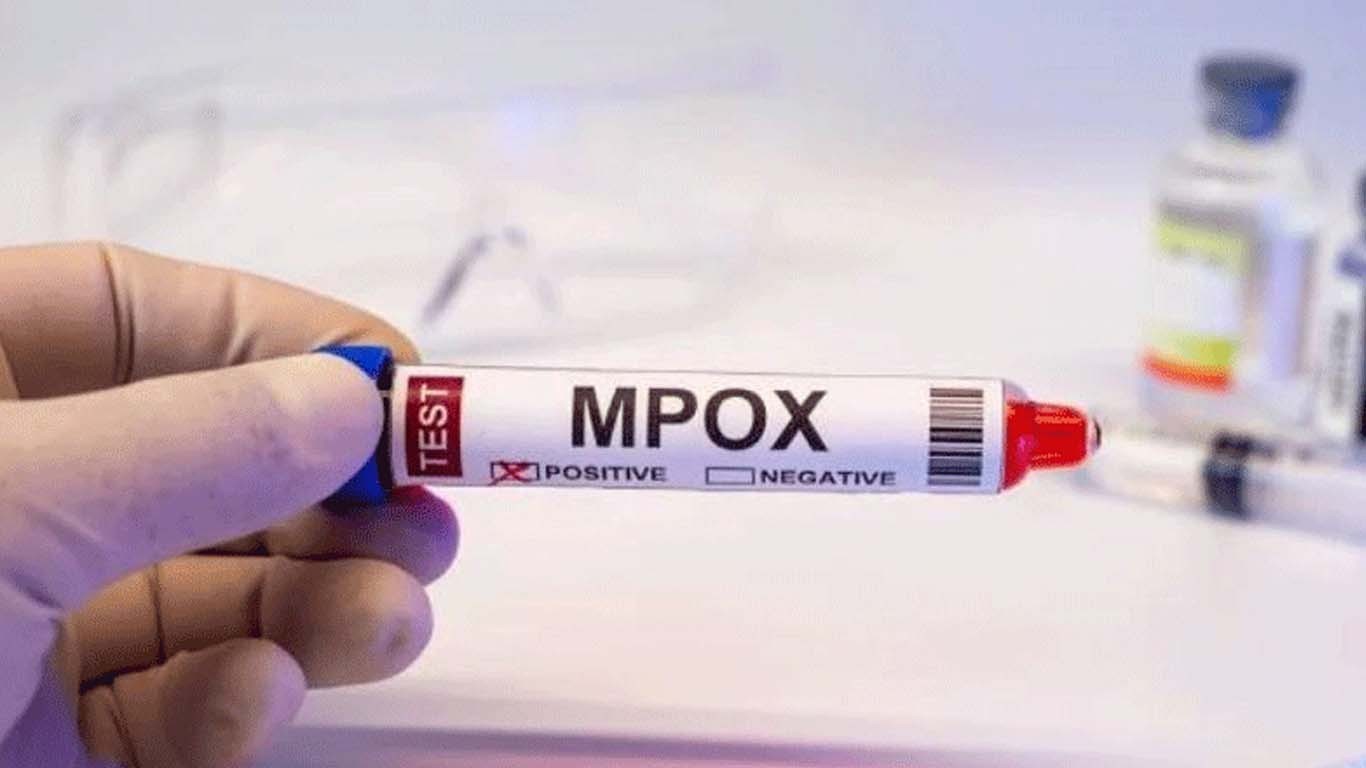کراچی میں منکی پاکس کا ایک اور کیس سامنے آگیا